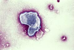 「抗体製剤」予防接種扱いに