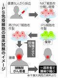 ｉＰＳ免疫細胞 がん縮小に効果