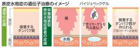 【医療新世紀】皮膚はがれる過酷な難病「表皮水疱症」