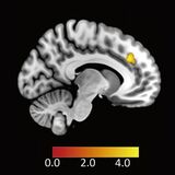 ヒトが不公平な提案を受け入れる時の脳内メカニズムを解明