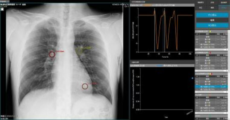研究グループが公開した研究機での解析の様子(コニカミノルタ提供)