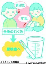 むくみ　気になったら尿検査を