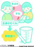 むくみ　気になったら尿検査を