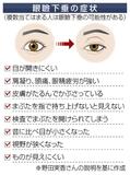 まぶたの異常 まず眼科へ