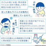 【人と社会と感染症　岡田教授のなるほど講座】（4）帯状疱疹　子どもは“…