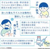 【人と社会と感染症　岡田教授のなるほど講座】（4）帯状疱疹…