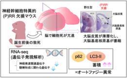脳発達に不可欠な受容体分子の新たな役割を発見