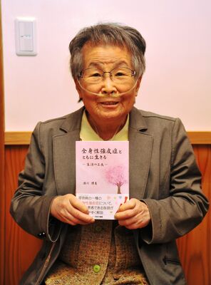 医師と患者の立場で全身性強皮症について語る満川さん