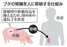 ブタ腎臓を人へ移植国内初治験へ