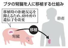 ブタ腎臓を人へ移植国内初治験へ