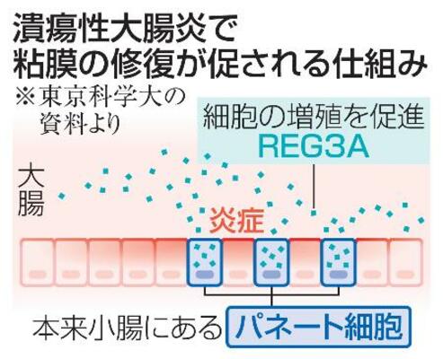 　潰瘍性大腸炎で粘膜の修復が促される仕組み
