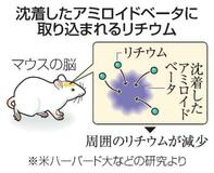 【夕刊】リチウム投与で認知症抑制