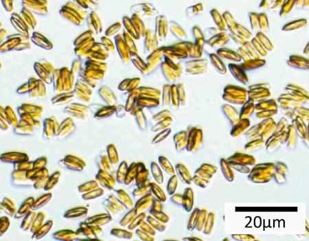 　ケイ藻を２００倍の倍率で撮影した顕微鏡写真（豊橋技術科学大提供）