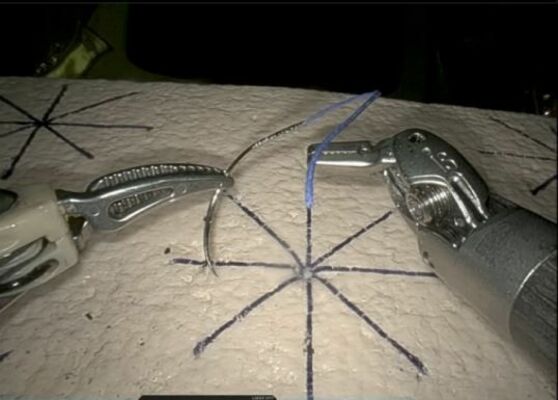 新開発したアイレス針を使用する手術用ロボット（マニー提供）