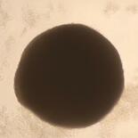 腎臓難病の治療薬候補発見