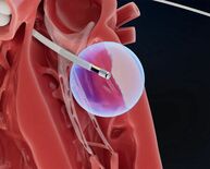 ヒトに対しては初となるField Medicalの6か月治療データがV…