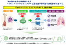 骨肉腫の「肺転移」を抑制するメカニズムを解明：骨肉腫の新規治療標的を発見