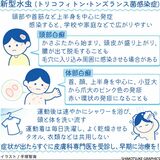 スポーツや学校で感染例もある「新型水虫」 練習後はすぐシャワー 症状出たら早期治療を【白鷗大・岡田教授が解説】