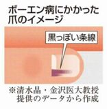 爪の黒っぽい縦線、ご用心