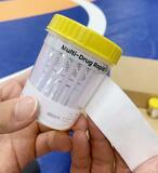 大学スポーツで薬物対策