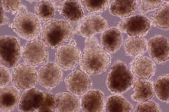 ｉＰＳ細胞の心筋球、承認申請へ