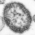 はしか患者、累計５１１人に