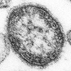 はしか患者、累計５１１人に