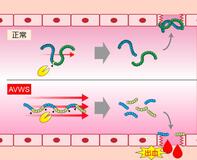 止血障害の治療薬開発へ