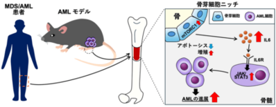 血液のがん・白血病の新しい治療標的を同定!