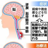 脳脊髄液減少症を知っていますか？　頭痛、だるさで通学できず　治療で日常…