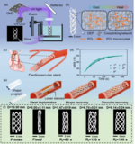 体温で自動的に展開する血管ステントを開発