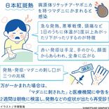 【人と社会と感染症　岡田教授のなるほど講座】（7）マダニ②日本紅斑熱　…