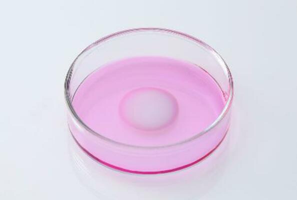 患者の膝の軟骨細胞を培養して移植する再生医療等製品「ジャック」(ジャパン・ティッシュエンジニアリング提供)