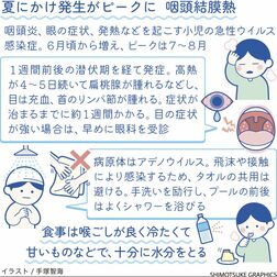 咽頭結膜熱　高熱と目の充血や目やに　タオルの共用で感染も【白鷗大・岡田教授が解説】