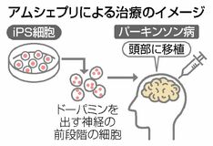 「アムシェプリ」保険適用