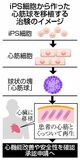 iPS心筋球 承認申請へ