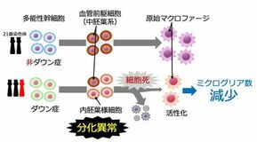ダウン症胎児の脳免疫細胞の発生に異常がある可能性を初めて発見