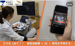 甲状腺腫瘍の悪性を予測するAIシステムで、地域間の医療格差をなくしたい！岐阜大学でｸﾗｳﾄﾞﾌｧﾝﾃﾞｨﾝｸﾞを開始
