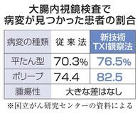 【からだ・こころナビ】映像自動調整で大腸内視鏡の精度向上