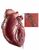 心臓血管内用の治療器具（右）