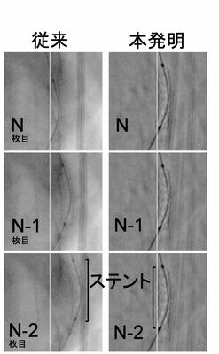発明機能が搭載されたＸ線アンギオグラフィシステム