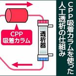 体内「老化物質」除去装置開発へ　自治医大発ベンチャー企業　３年後に製品…