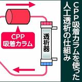 体内「老化物質」除去装置開発へ　自治医大発ベンチャー企業　３年後に製品化目指す