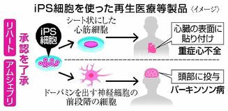 ｉＰＳ再生医療 実用化へ