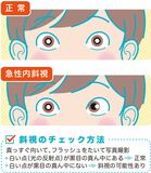スマホや携帯型ゲーム　長時間使用で斜視もルール決め適度に使おう