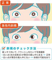 スマホや携帯型ゲーム　長時間使用で斜視もルール決め適度に使おう