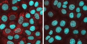 ＡＬＳ、化合物で制御期待