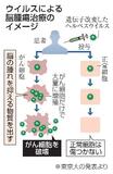 脳腫瘍新ウイルス療法治験開始へ