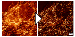 蛍光顕微鏡の観察精度を高める技術で生きた細胞の内部構造がより鮮明に