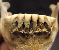 人骨歯石からキビ食確認